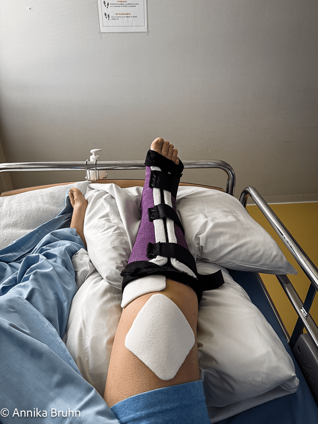 mein Super Gips